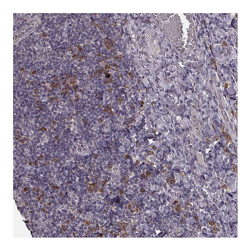 Atlas Antibodies Anti-P2RX5 Antibody