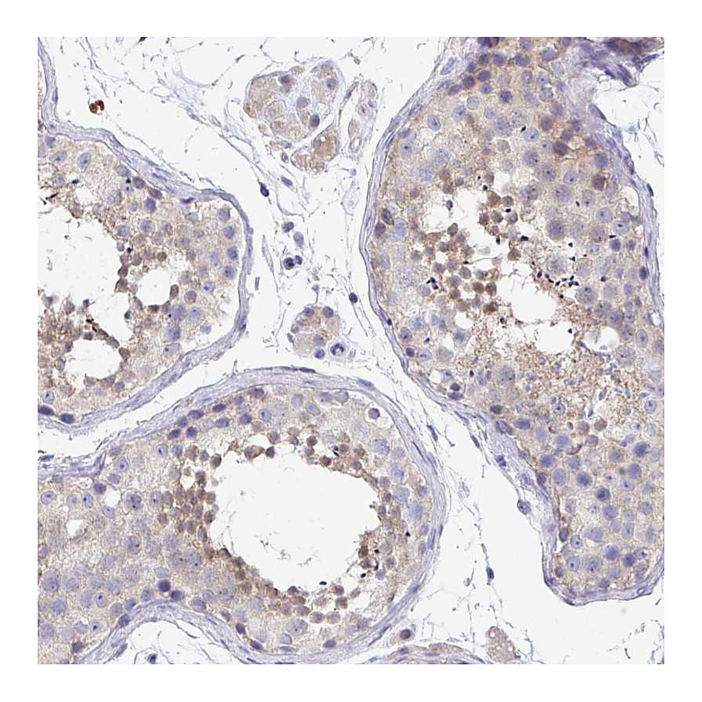 Atlas Antibodies Anti-P2RX3 Antibody