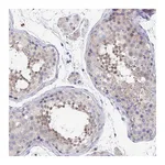 Atlas Antibodies Anti-P2RX3 Antibody
