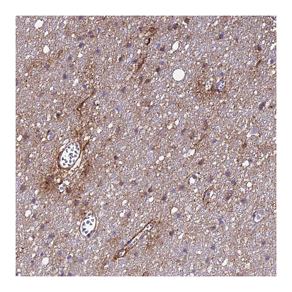 Atlas Antibodies Anti-P2RX7 Antibody