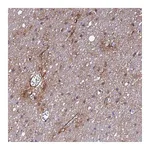 Atlas Antibodies Anti-P2RX7 Antibody