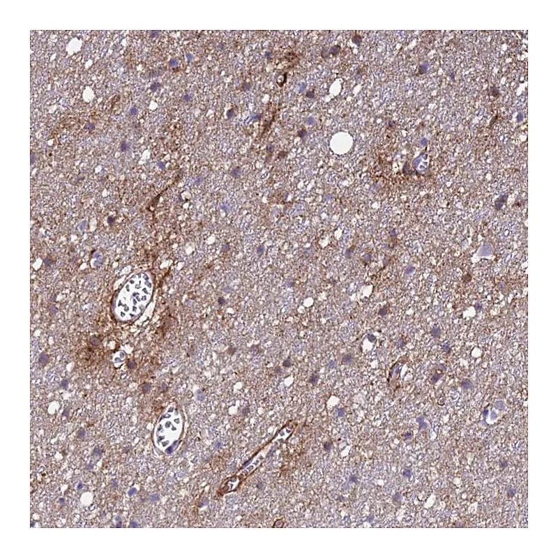 Atlas Antibodies Anti-P2RX7 Antibody