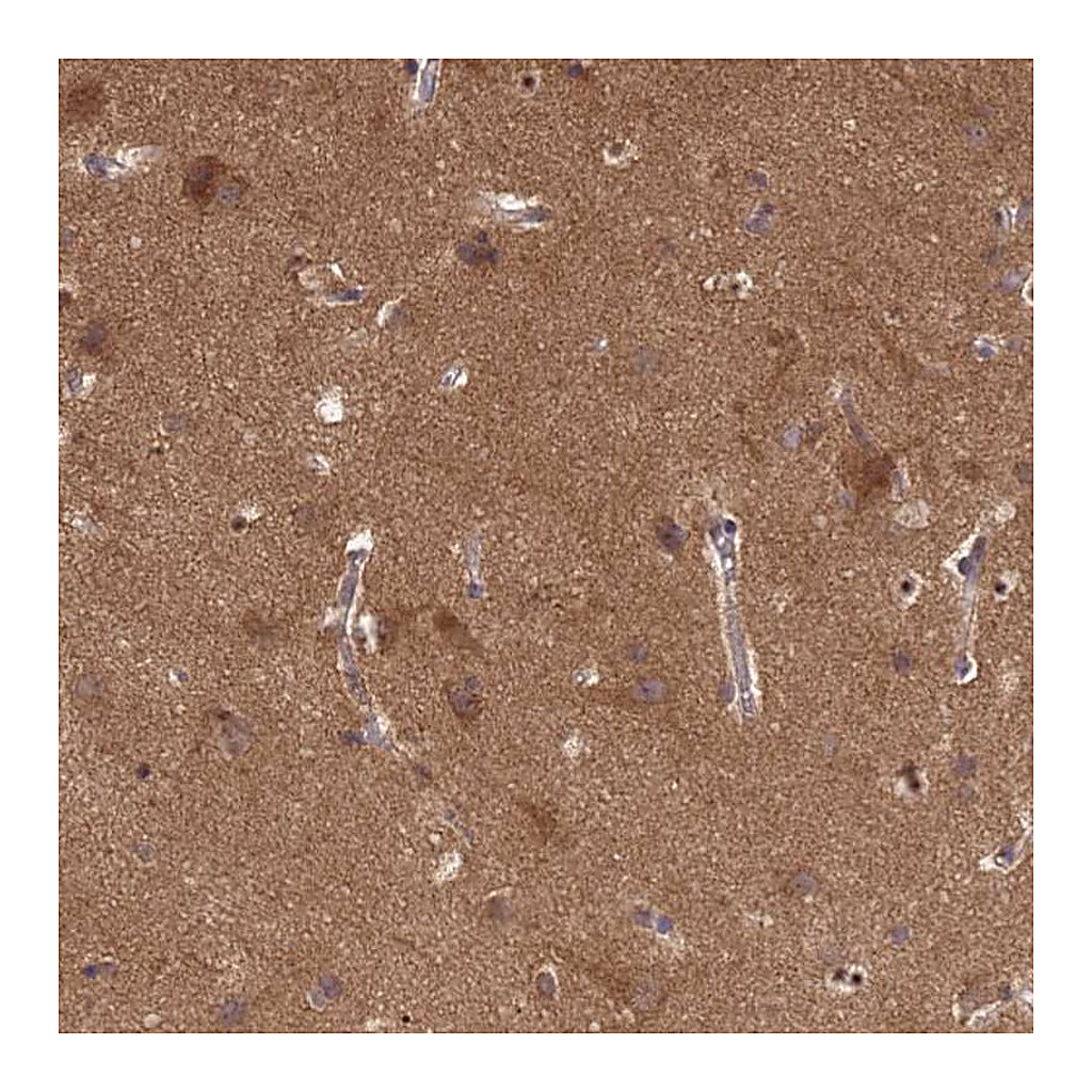 Atlas Antibodies Anti-P2RX7 Antibody
