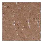 Atlas Antibodies Anti-P2RX7 Antibody