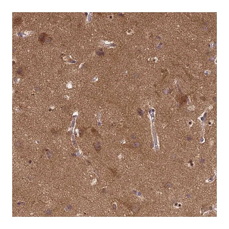 Atlas Antibodies Anti-P2RX7 Antibody