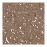 Atlas Antibodies Anti-P2RX7 Antibody