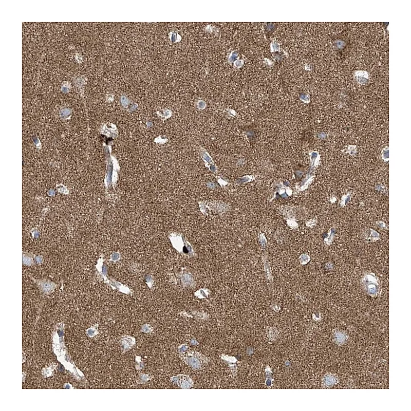 Atlas Antibodies Anti-P2RX7 Antibody