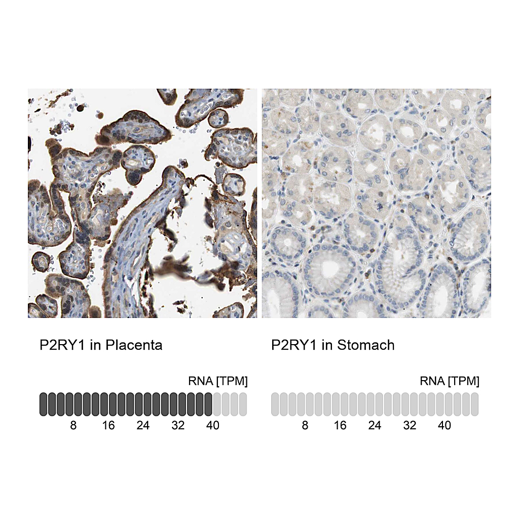Atlas Antibodies Anti-P2RY1 Antibody