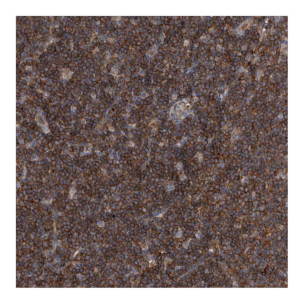 Atlas Antibodies Anti-P2RY10 Antibody