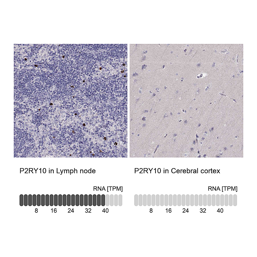 Atlas Antibodies Anti-P2RY10 Antibody
