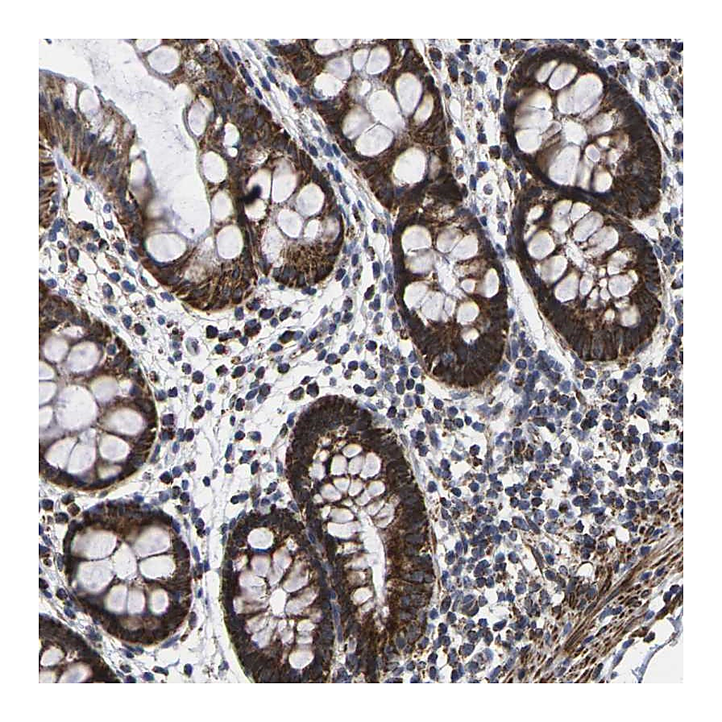 Atlas Antibodies Anti-P2RY11 Antibody