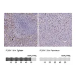 Atlas Antibodies Anti-P2RY13 Antibody