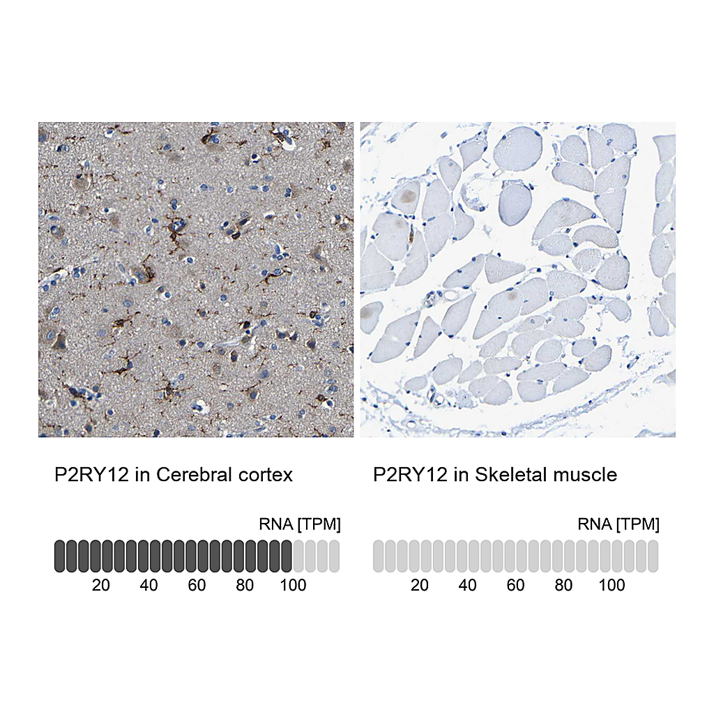 Atlas Antibodies Anti-P2RY12 Antibody
