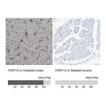 Atlas Antibodies Anti-P2RY12 Antibody