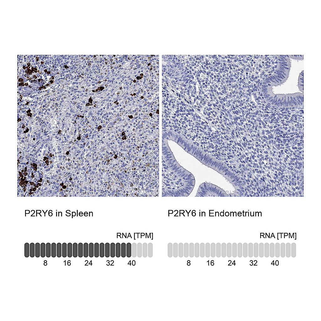 Atlas Antibodies Anti-P2RY6 Antibody