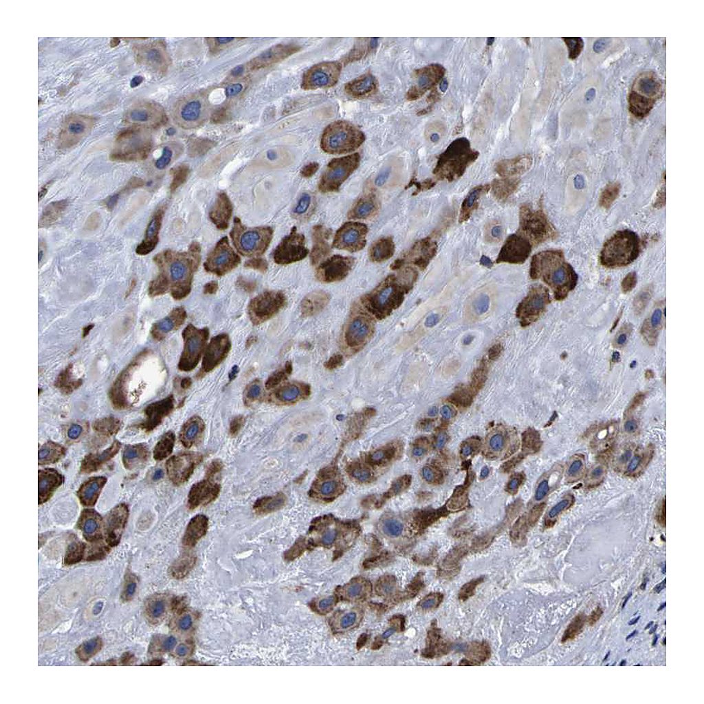Atlas Antibodies Anti-P3H1 Antibody