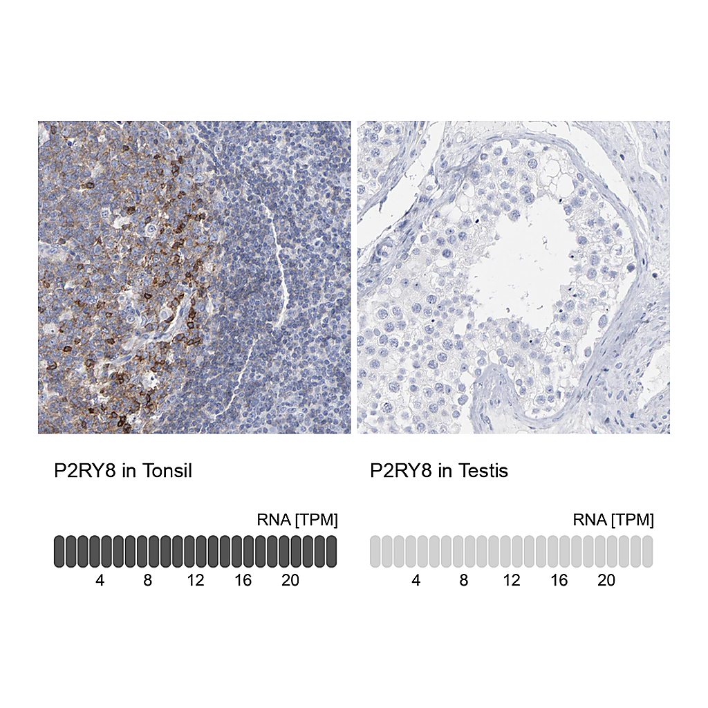 Atlas Antibodies Anti-P2RY8 Antibody