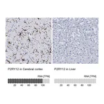 Atlas Antibodies Anti-P2RY12 Antibody