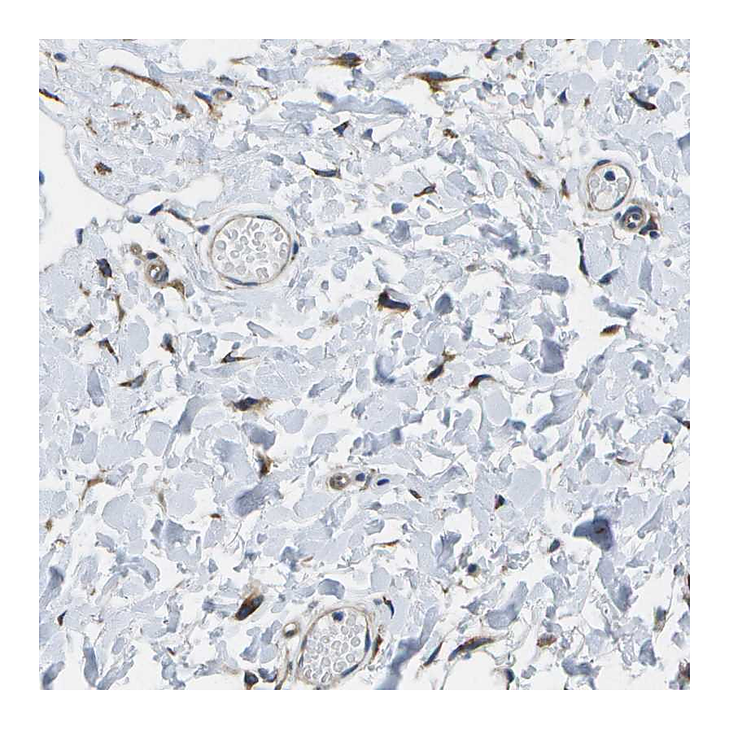 Atlas Antibodies Anti-P3H1 Antibody
