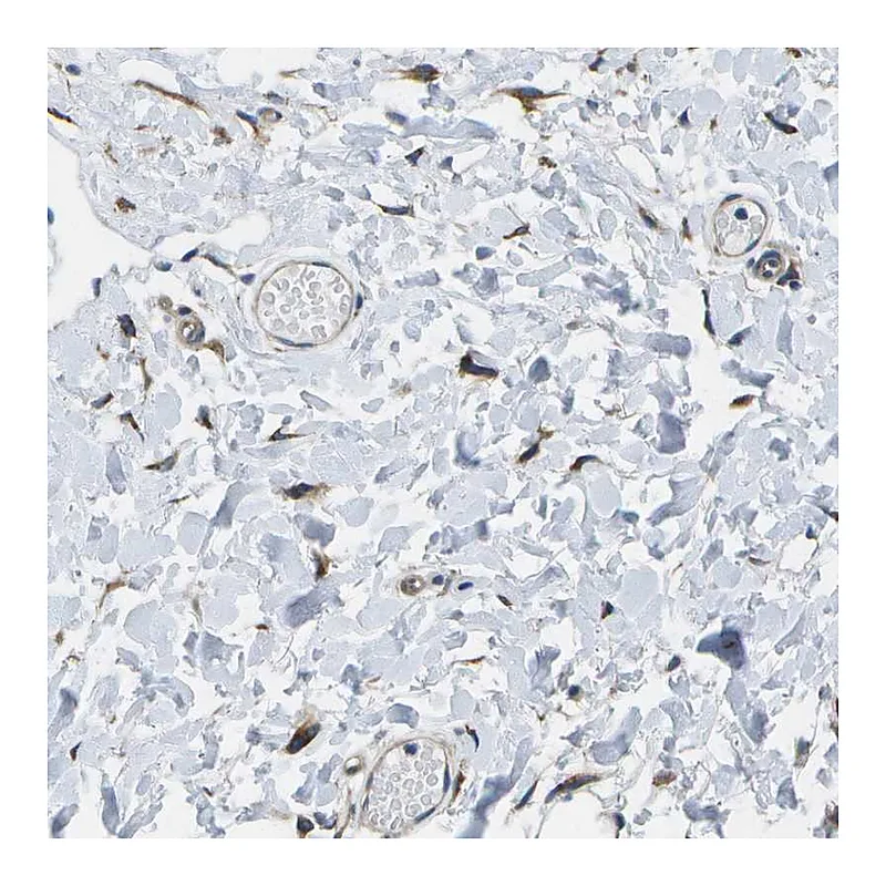 Atlas Antibodies Anti-P3H1 Antibody