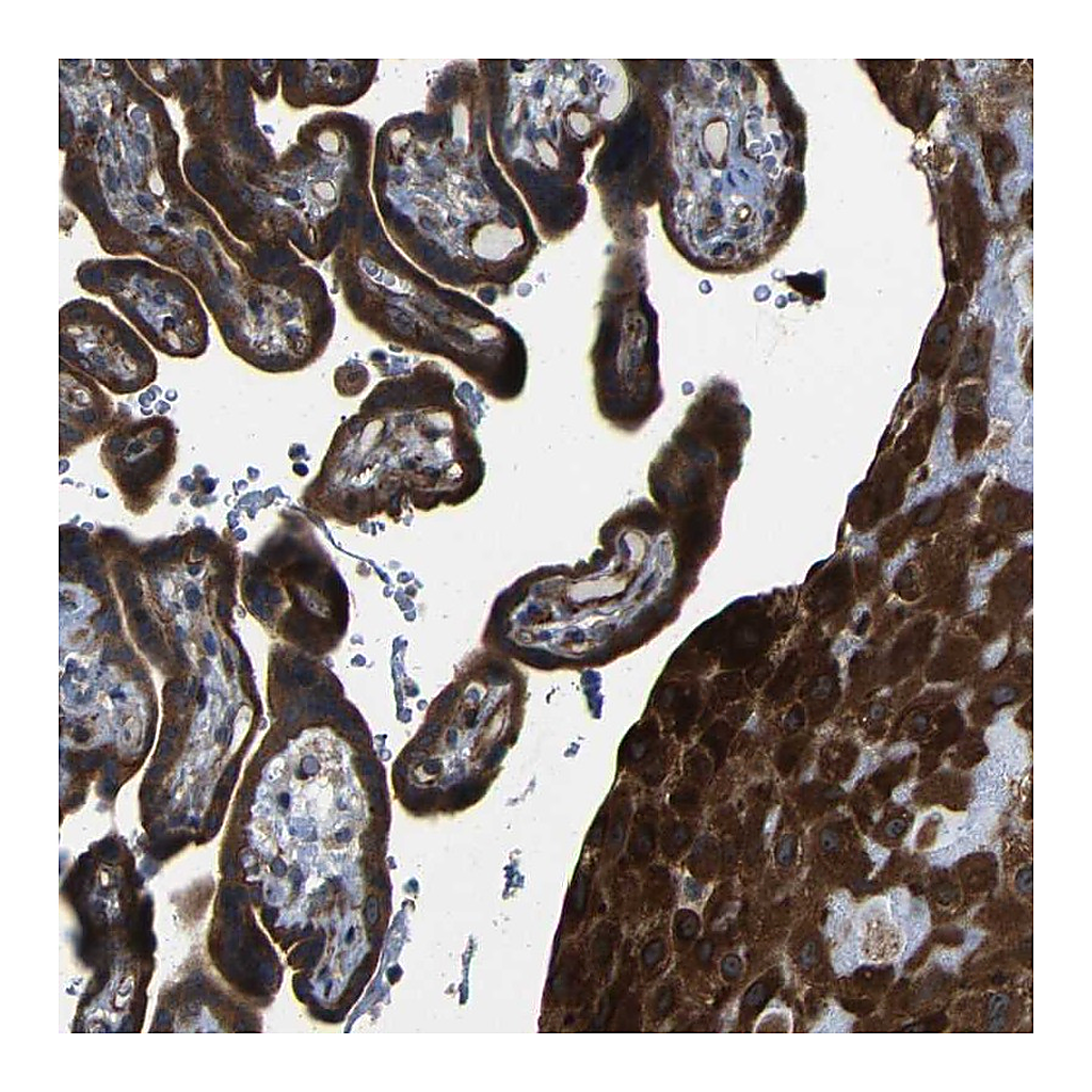 Atlas Antibodies Anti-P3H2 Antibody