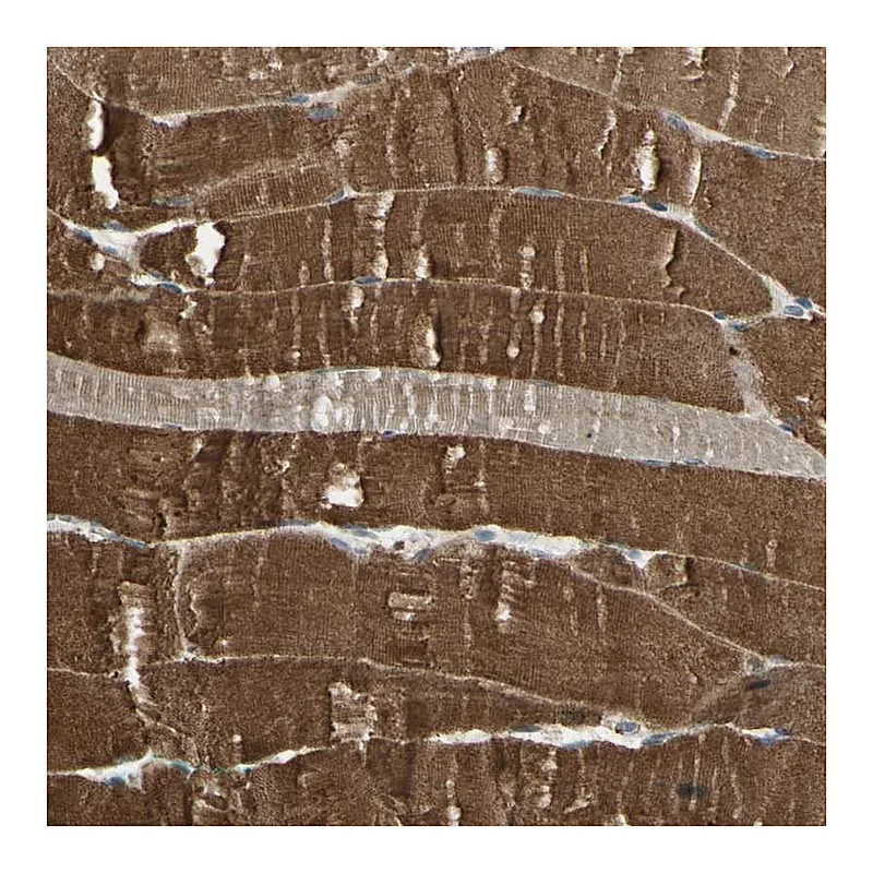 Atlas Antibodies Anti-P3H2 Antibody