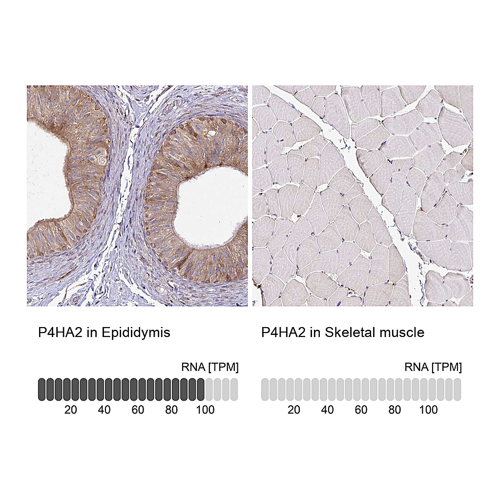 Atlas Antibodies Anti-P4HA2 Antibody