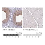 Atlas Antibodies Anti-P4HA2 Antibody