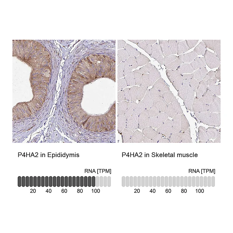 Atlas Antibodies Anti-P4HA2 Antibody