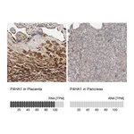 Atlas Antibodies Anti-P4HA1 Antibody