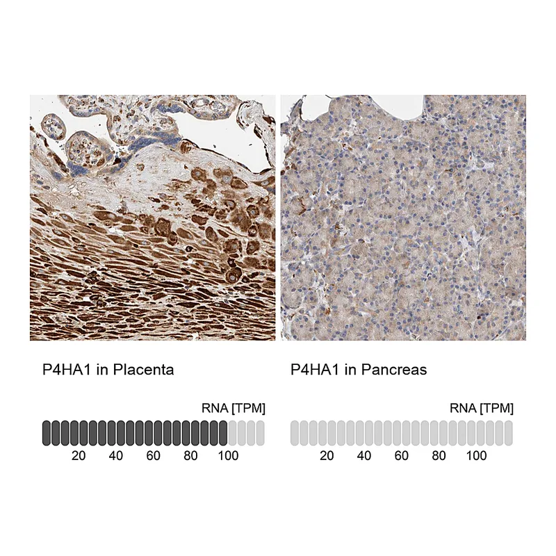 Atlas Antibodies Anti-P4HA1 Antibody