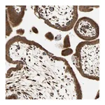 Atlas Antibodies Anti-P4HA1 Antibody