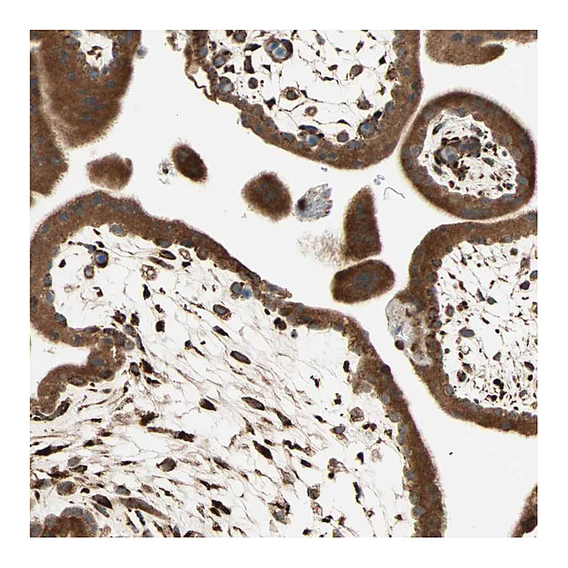 Atlas Antibodies Anti-P4HA1 Antibody