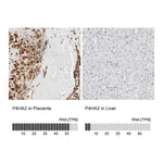 Atlas Antibodies Anti-P4HA2 Antibody