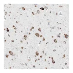 Atlas Antibodies Anti-P4HTM Antibody