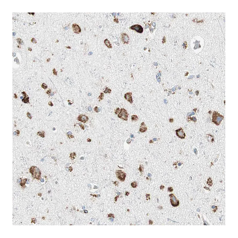 Atlas Antibodies Anti-P4HTM Antibody
