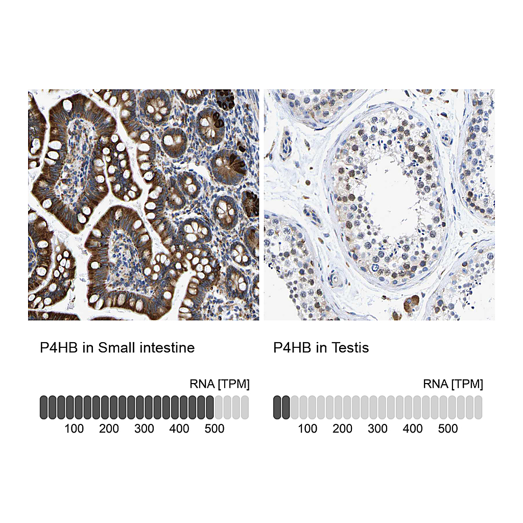 Atlas Antibodies Anti-P4HB Antibody