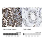 Atlas Antibodies Anti-P4HB Antibody