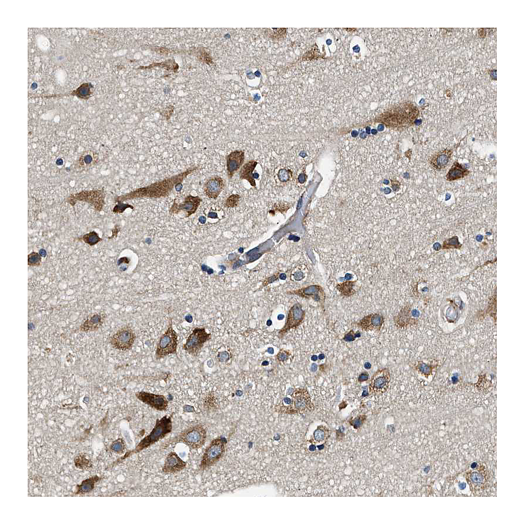 Atlas Antibodies Anti-PA2G4 Antibody