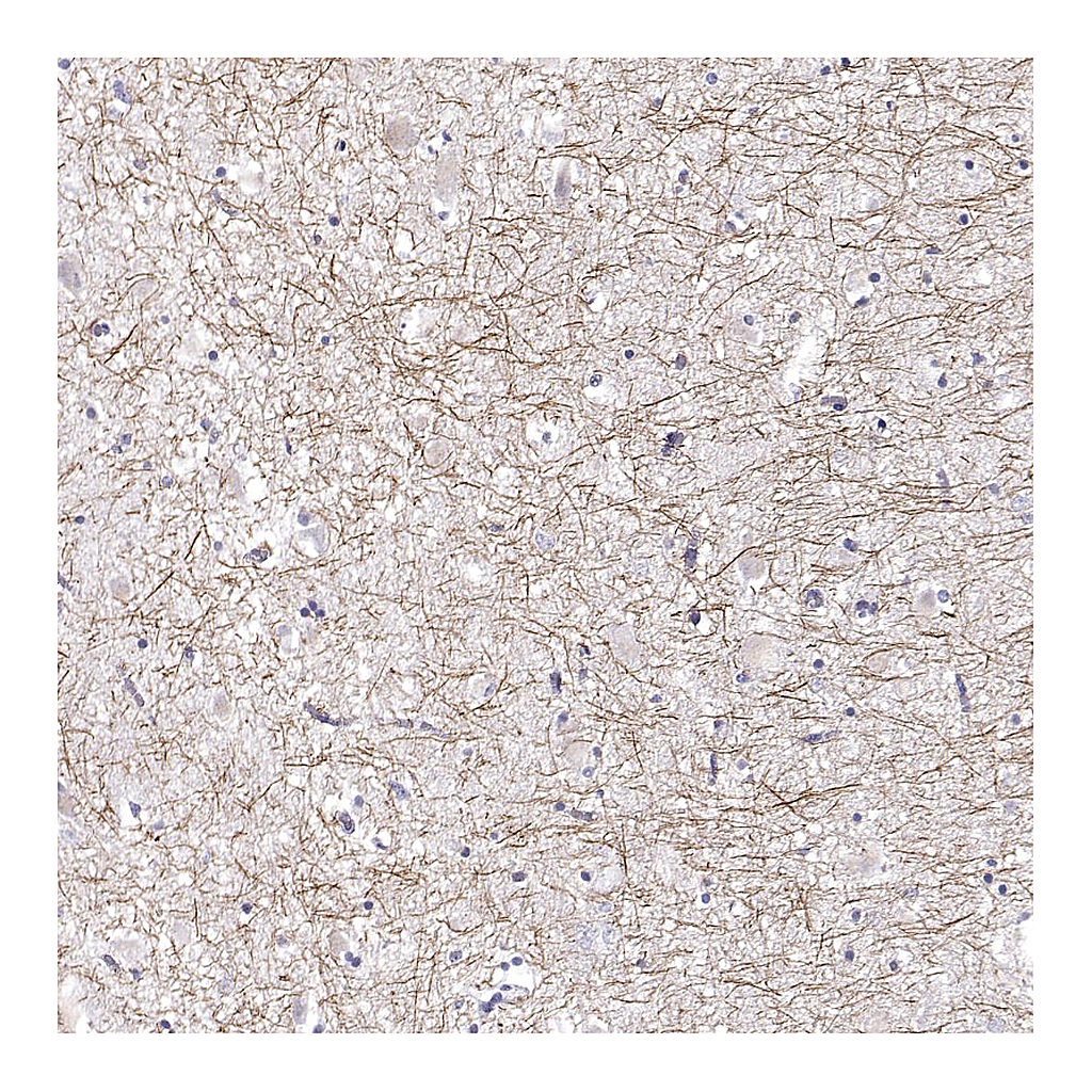 Atlas Antibodies Anti-PABPC1L2A Antibody