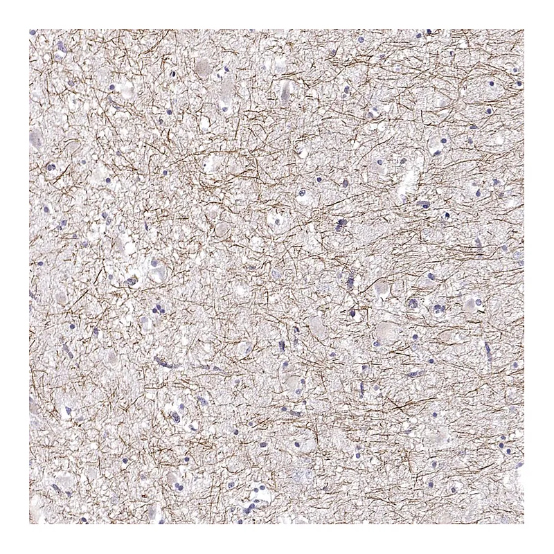 Atlas Antibodies Anti-PABPC1L2A Antibody