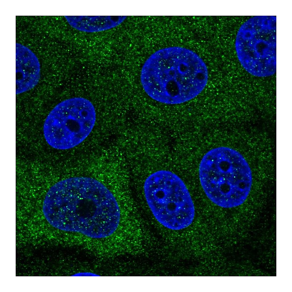 Atlas Antibodies Anti-PABPC1L Antibody