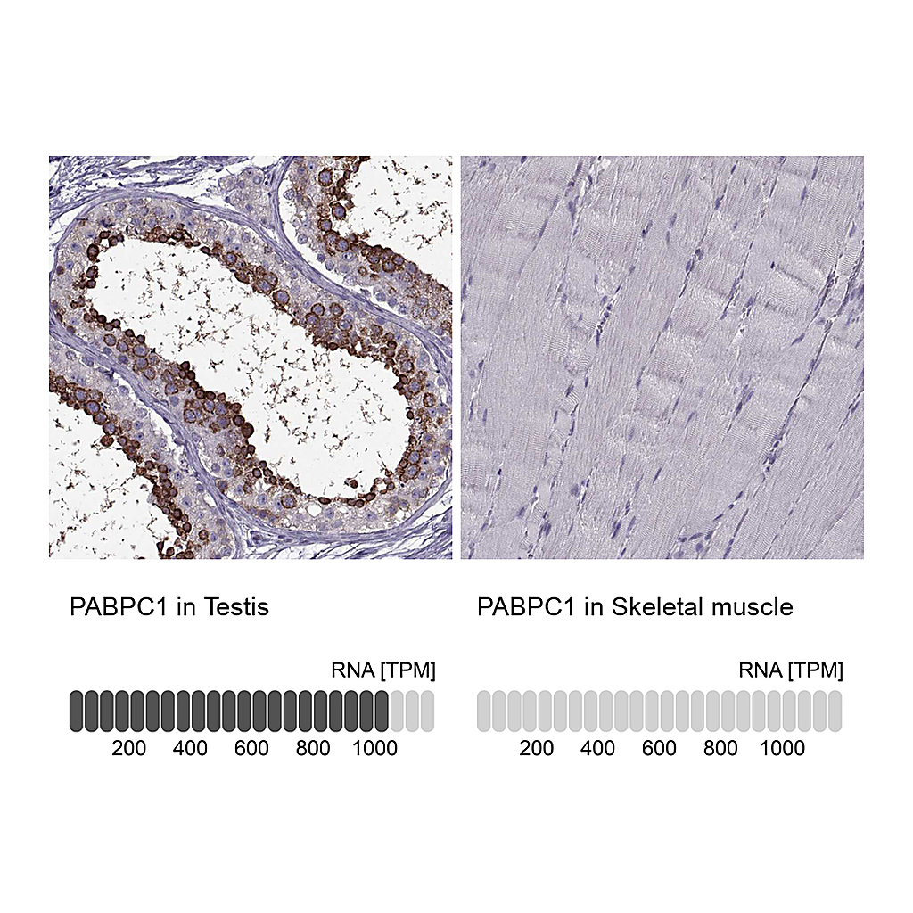 Atlas Antibodies Anti-PABPC1 Antibody