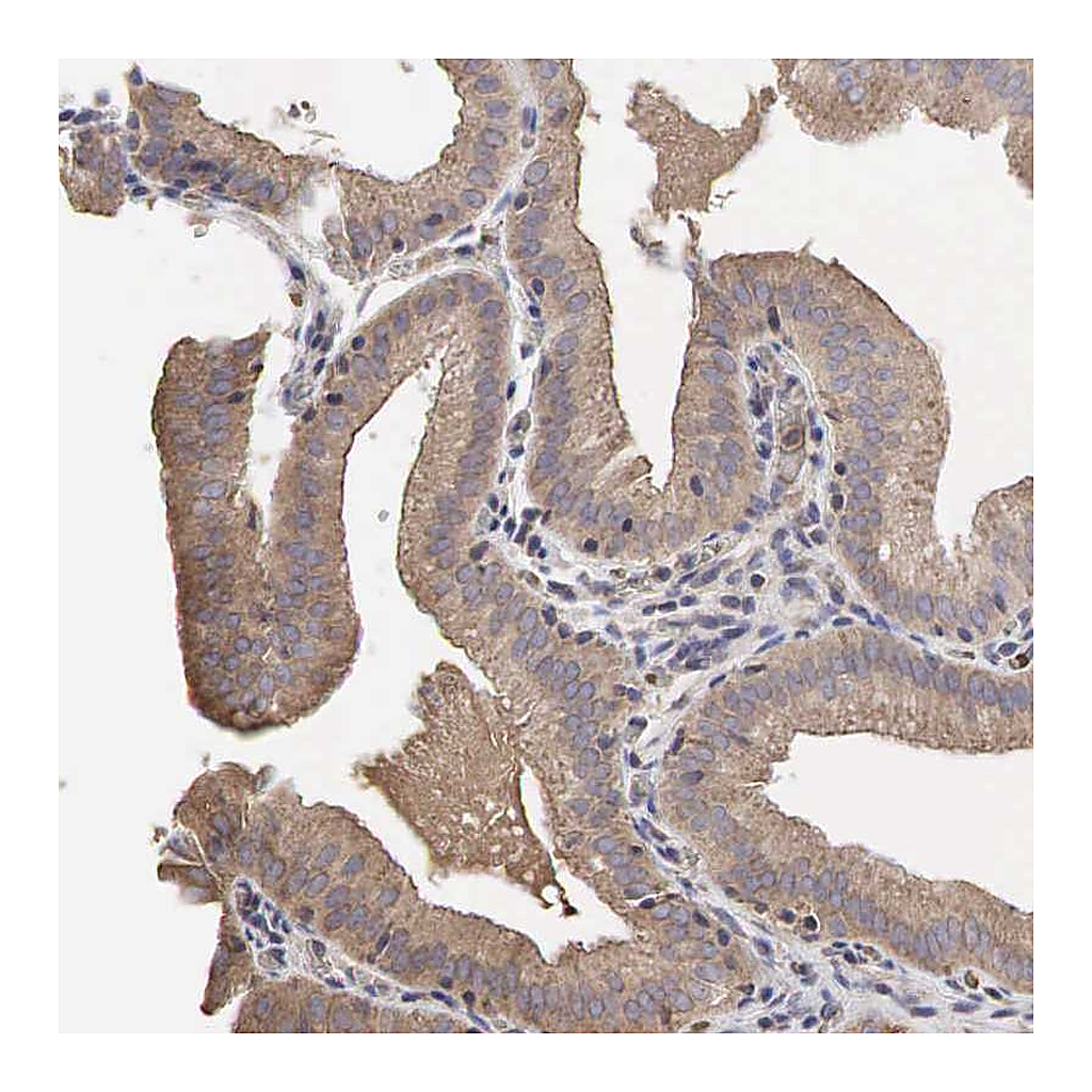 Atlas Antibodies Anti-PABPC5 Antibody