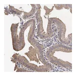 Atlas Antibodies Anti-PABPC5 Antibody