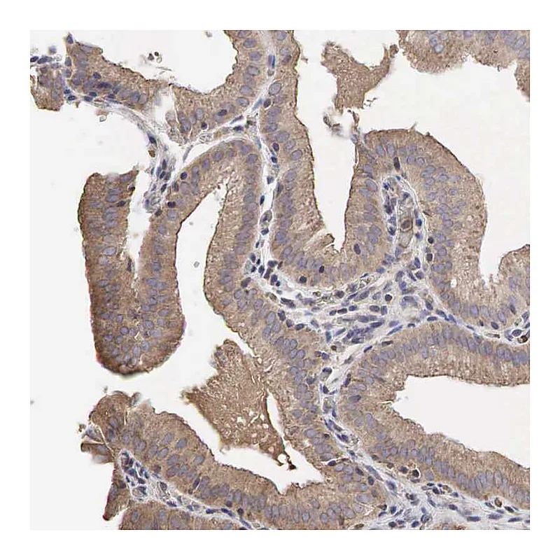 Atlas Antibodies Anti-PABPC5 Antibody