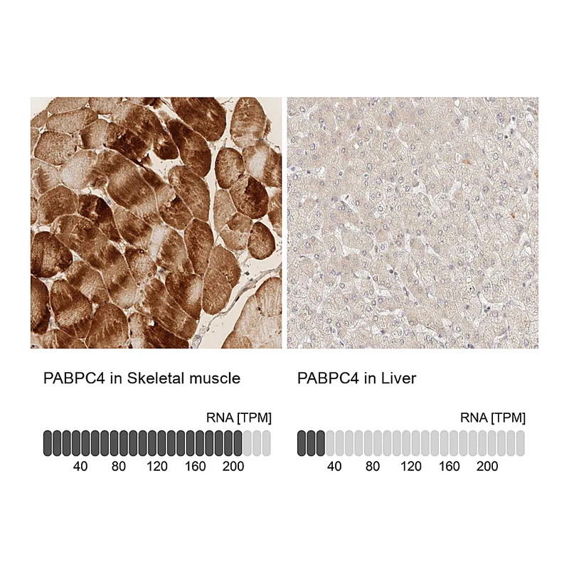 Atlas Antibodies Anti-PABPC4 Antibody