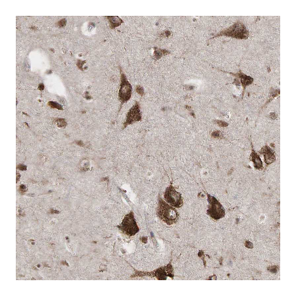 Atlas Antibodies Anti-PABPC5 Antibody