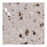 Atlas Antibodies Anti-PABPC5 Antibody