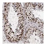 Atlas Antibodies Anti-PABPN1 Antibody